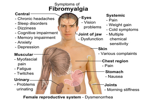 fibromyalgia-symptom-graphic